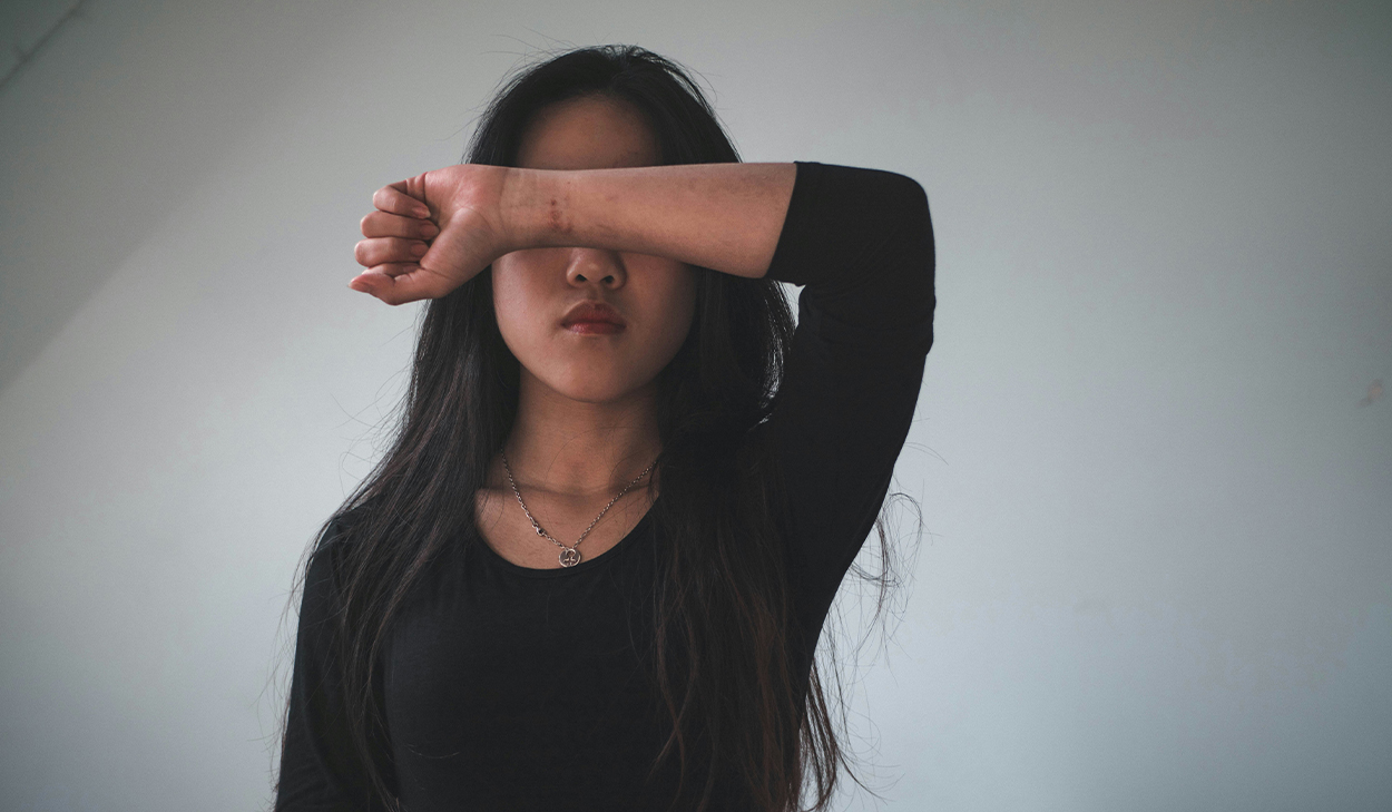 A women with her arm covering her eyes with a serious face.